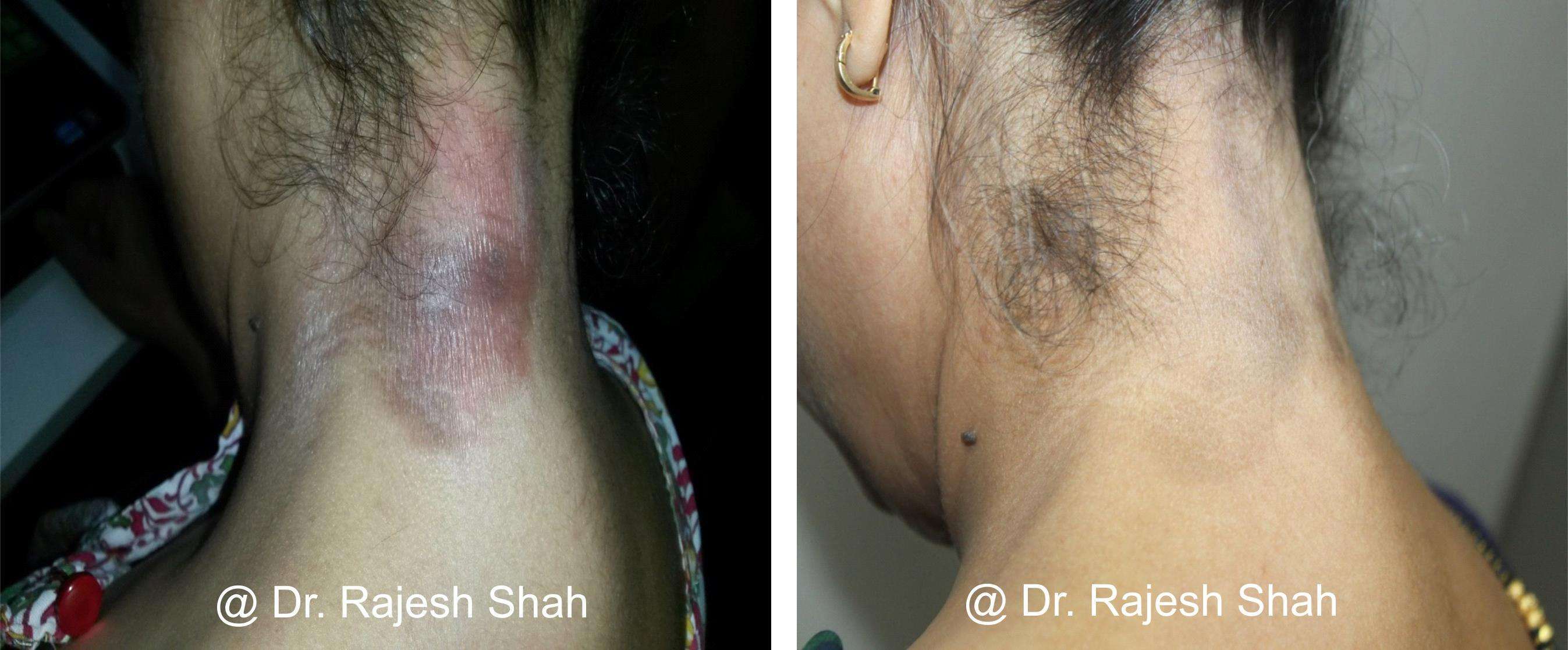 lifeforce homeopathy case-photos